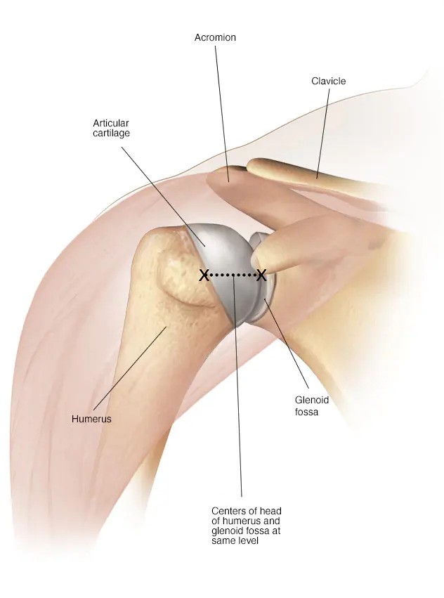 revision_surgery Revision hip and knee replacement surgery in Jaipur